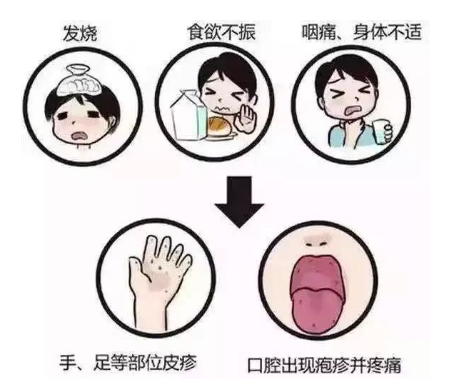 高发季!做好小儿手足口病的防护(图1)