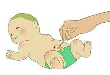 新生儿脐带护理，家长需要掌握哪些技巧？(图1)