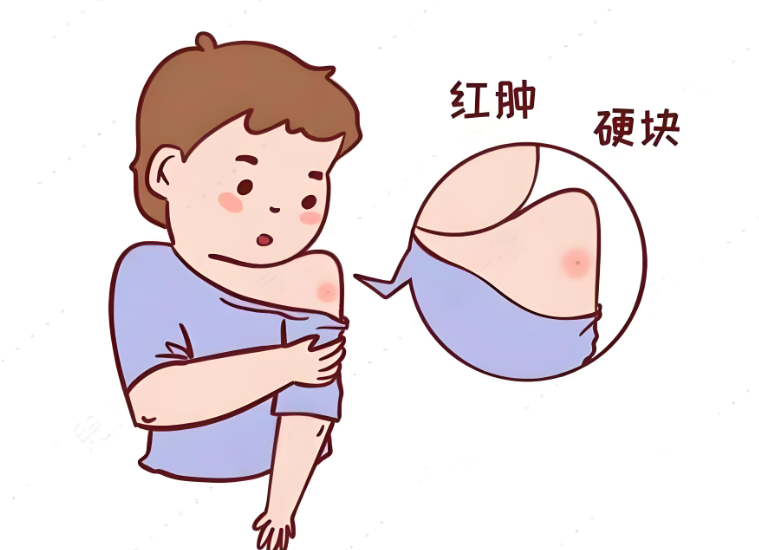 预防接种部位红肿，这样护理正确吗？(图1)