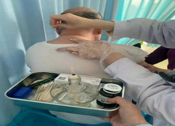 偏瘫康复之旅：火针治疗的“奇妙”体验(图2)